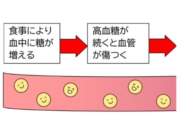 血管と糖のイメージ画像