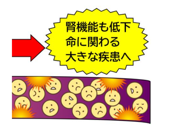 血管のダメージのイメージ画像